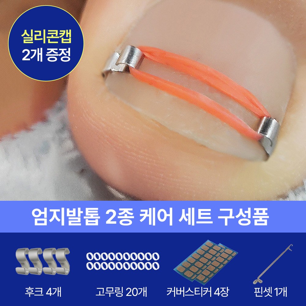 추천 인기 내성발톱교정기 10종 지금 바로 구매하세요!